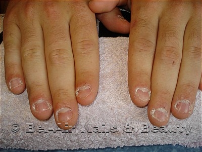 mannelijke nagelbijter